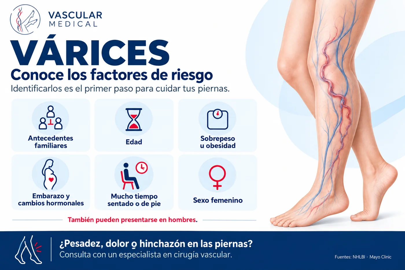 Infografía de Vascular Medical con los factores de riesgo de las várices: antecedentes familiares, edad, sobrepeso, embarazo, estar mucho tiempo sentado o de pie y sexo femenino