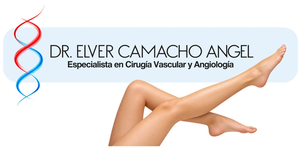Dr. Elver Camacho Ángel, especialista en Cirugía Vascular y Angiología